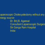 Laparoscopic Cholecystectomy without any energy source - Detailed procedural video