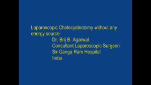 Laparoscopic Cholecystectomy without any energy source - Detailed procedural video